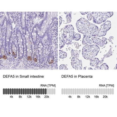 Immunohistochemistry analysis in human small intestine and placenta tissues using Anti-DEFA5 antibody. Corresponding DEFA5 RNA-seq data are presented for the same tissues.