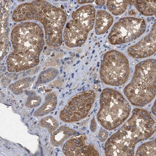 Immunohistochemical staining of human kidney shows cytoplasmic positivity in renal tubules.