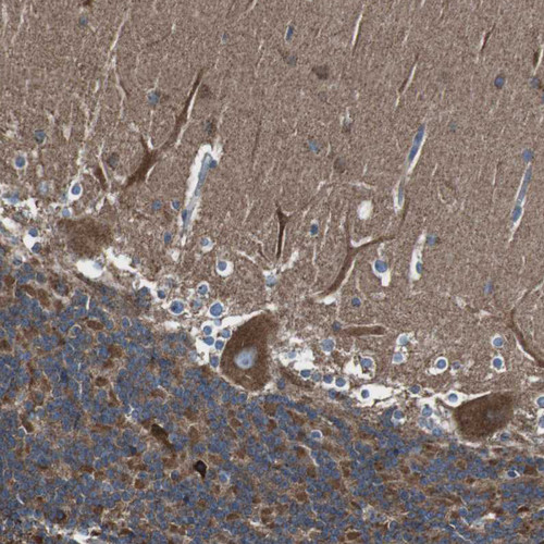 Immunohistochemical staining of human Cerebellum shows strong cytoplasmic positivity in Purkinje cells.