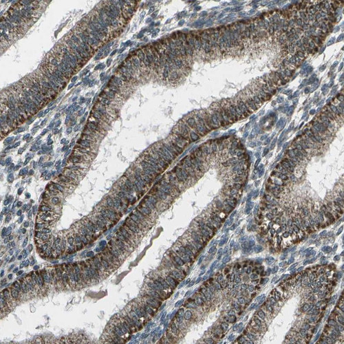 Immunohistochemical staining of human corpus, uterine shows strong cytoplasmic positivity in glandular cells.