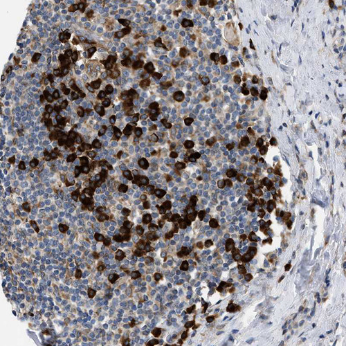 Immunohistochemical staining of human tonsil shows moderate to strong cytoplasmic positivity in lymphoid cells.