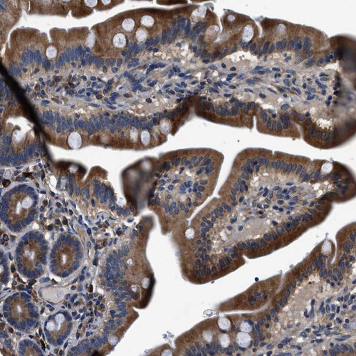 Immunohistochemical staining of human duodenum shows cytoplasmic positivity in glandular cells.