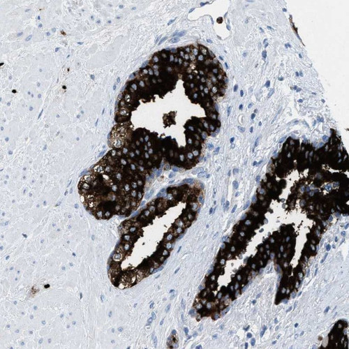 Immunohistochemical staining of human prostate shows strong cytoplasmic positivity in glandular cells.