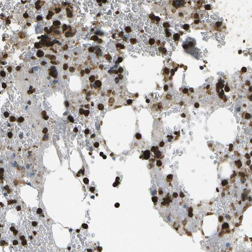 Immunohistochemical staining of human bone marrow shows strong cytoplasmic positivity in subsets of bone marrow poietic cells.