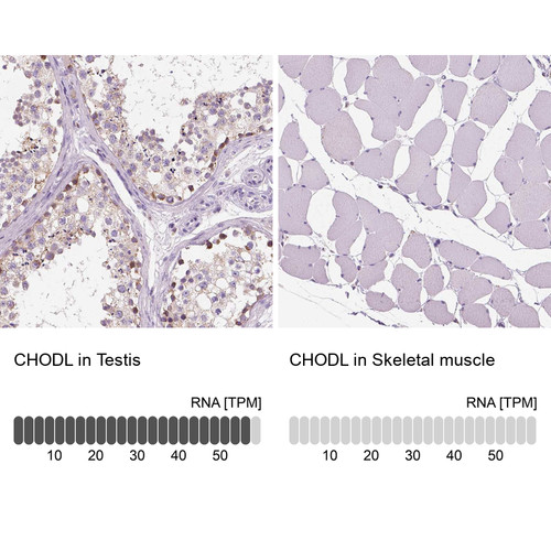 Immunohistochemistry analysis in human testis and skeletal muscle tissues using Anti-CHODL antibody. Corresponding CHODL RNA-seq data are presented for the same tissues.