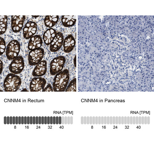 Immunohistochemistry analysis in human rectum and pancreas tissues using Anti-CNNM4 antibody. Corresponding CNNM4 RNA-seq data are presented for the same tissues.