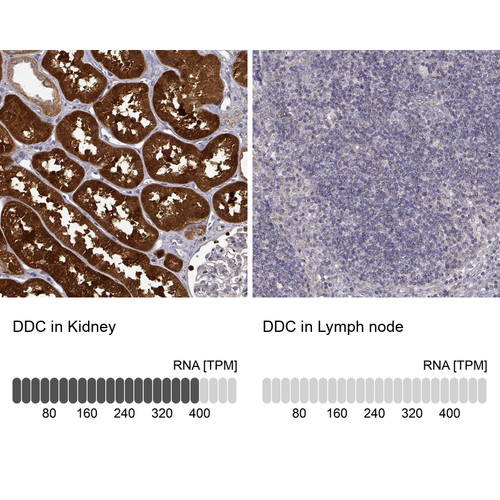 Immunohistochemistry analysis in human kidney and lymph node tissues using Anti-DDC antibody. Corresponding DDC RNA-seq data are presented for the same tissues.