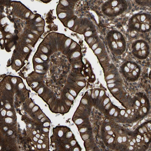 Immunohistochemical staining of human small intestine shows strong membranous, and cytoplasmic positivity in glandular cells.