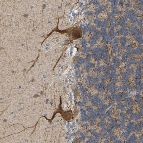 Immunohistochemical staining of human cerebellum shows moderate cytoplasmic positivity in cerebellar tissue.