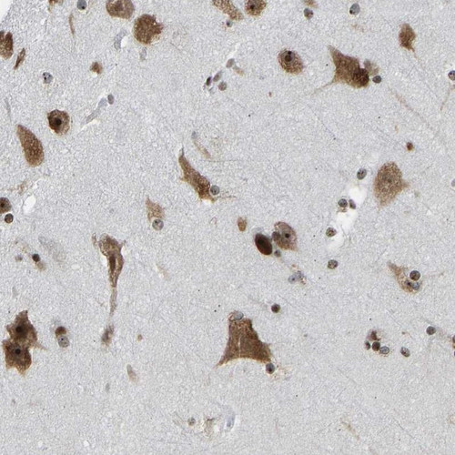 Immunohistochemical staining of human cerebral cortex shows strong cytoplasmic and nuclear positivity in neuronal cells.