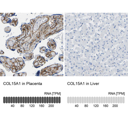 Immunohistochemistry analysis in human placenta and liver tissues using HPA017915 antibody. Corresponding COL15A1 RNA-seq data are presented for the same tissues.