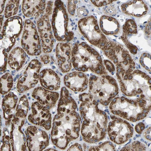 Immunohistochemical staining of human kidney shows strong cytoplasmic positivity in cells in tubules.