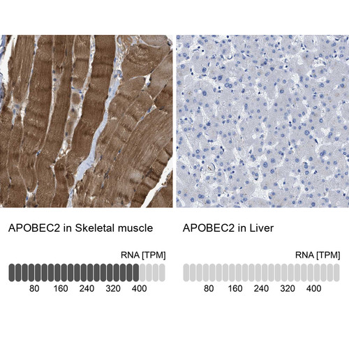 Immunohistochemistry analysis in human skeletal muscle and liver tissues using HPA017957 antibody. Corresponding APOBEC2 RNA-seq data are presented for the same tissues.