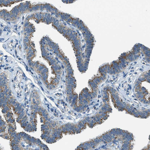Immunohistochemical staining of human Fallopian tube shows strong granular cytoplasmic positivity in glandular cells.