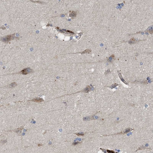 Immunohistochemical staining of human cerebral cortex shows cytoplasmic positivity in neurons.
