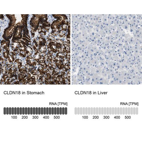 Immunohistochemistry analysis in human stomach and liver tissues using HPA018446 antibody. Corresponding CLDN18 RNA-seq data are presented for the same tissues.