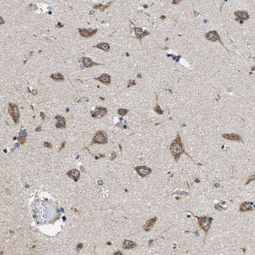 Immunohistochemical staining of human hippocampus shows moderate positivity in neuronal cells.