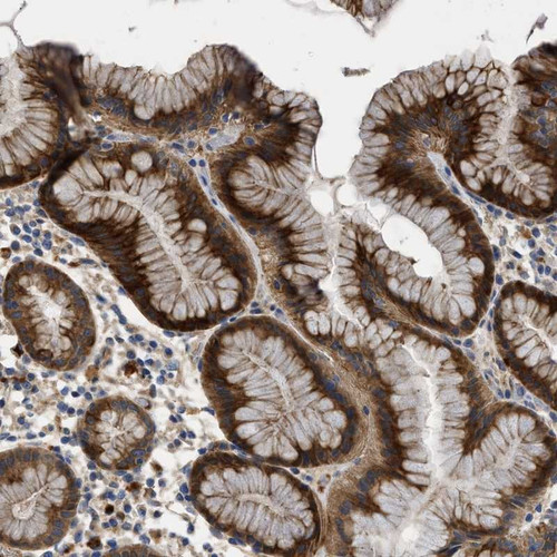Immunohistochemical staining of human stomach shows strong cytoplasmic positivity in glandular cells.