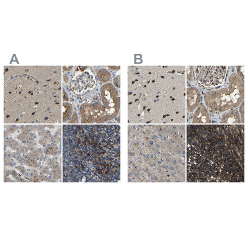 Immunohistochemical staining of human cerebral cortex, kidney, liver and lymph node using Anti-ATP8B1 antibody HPA018674 (A) shows similar protein distribution across tissues to independent antibody HPA018673 (B).