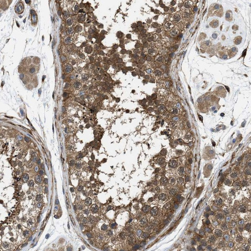 Immunohistochemical staining of human testis shows cytoplasmic positivity in cells in seminiferous ducts and Leydig cells. 