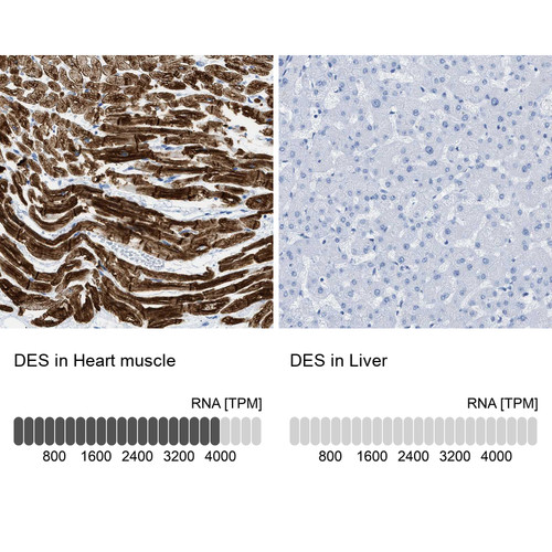 Immunohistochemistry analysis in human heart muscle and liver tissues using HPA018803 antibody. Corresponding DES RNA-seq data are presented for the same tissues.