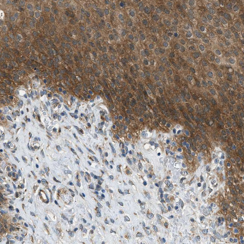 Immunohistochemical staining of human urinary bladder shows strong cytoplasmic positivity in urothelial cells.