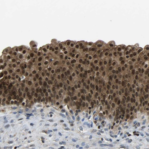 Immunohistochemical staining of human urinary bladder shows nuclear positivity in urothelial cells.