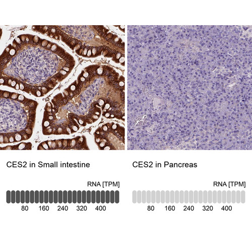 Immunohistochemistry analysis in human small intestine and pancreas tissues using Anti-CES2 antibody. Corresponding CES2 RNA-seq data are presented for the same tissues.