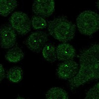 Immunofluorescent staining of human cell line HEL shows localization to nucleoplasm & nuclear bodies.