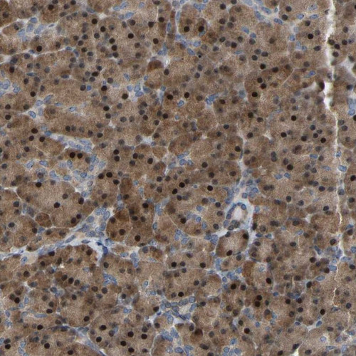 Immunohistochemical staining of human pancreas shows strong cytoplasmic and nuclear positivity in exocrine glandular cells.