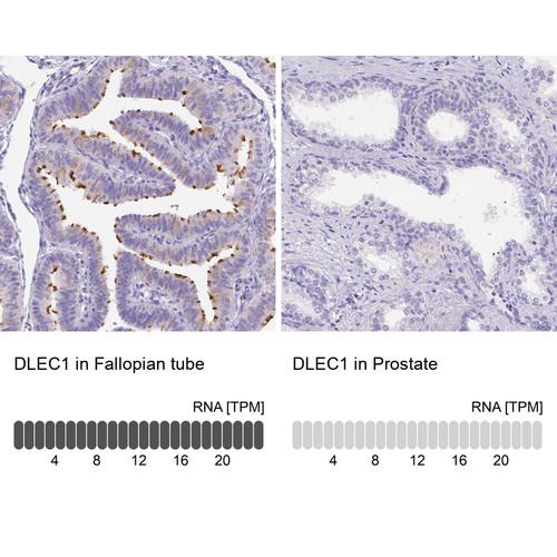 Immunohistochemistry analysis in human fallopian tube and prostate tissues using Anti-DLEC1 antibody. Corresponding DLEC1 RNA-seq data are presented for the same tissues.