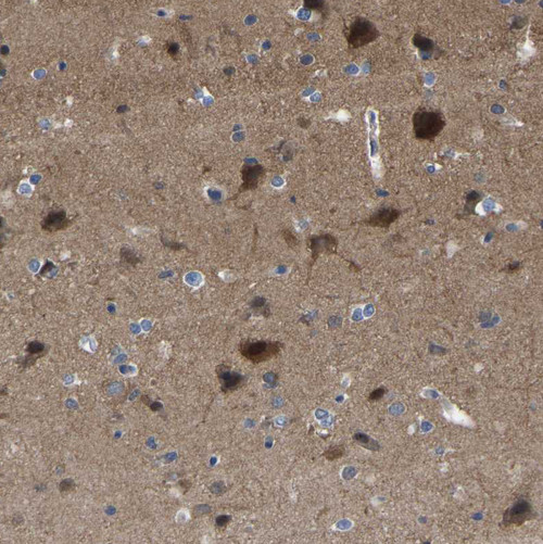 Immunohistochemical staining of human cerebral cortex shows strong cytoplasmic positivity in neurons.