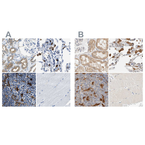 Immunohistochemical staining of human kidney, lung, lymph node and skeletal muscle using Anti-CAPG antibody HPA019092 (A) shows similar protein distribution across tissues to independent antibody HPA018843 (B).