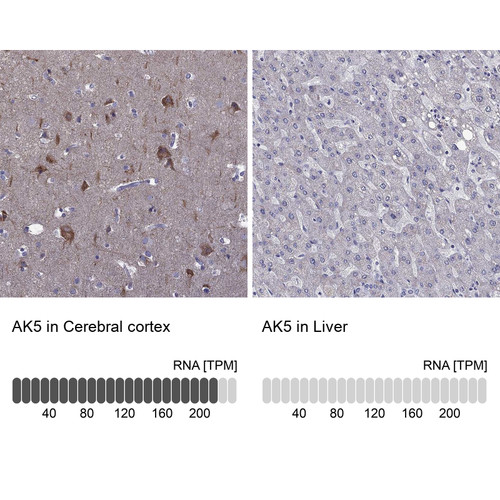 Immunohistochemistry analysis in human cerebral cortex and liver tissues using Anti-AK5 antibody. Corresponding AK5 RNA-seq data are presented for the same tissues.
