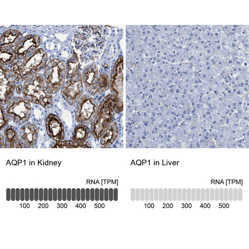Immunohistochemistry analysis in human kidney and liver tissues using HPA019206 antibody. Corresponding AQP1 RNA-seq data are presented for the same tissues.