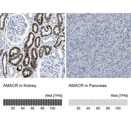 Immunohistochemistry analysis in human kidney and pancreas tissues using Anti-AMACR antibody. Corresponding AMACR RNA-seq data are presented for the same tissues.