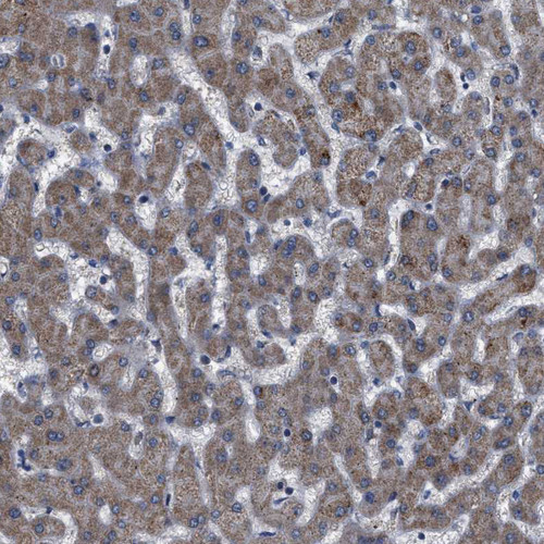 Immunohistochemical staining of human liver shows strong cytoplasmic positivity in hepatocytes.