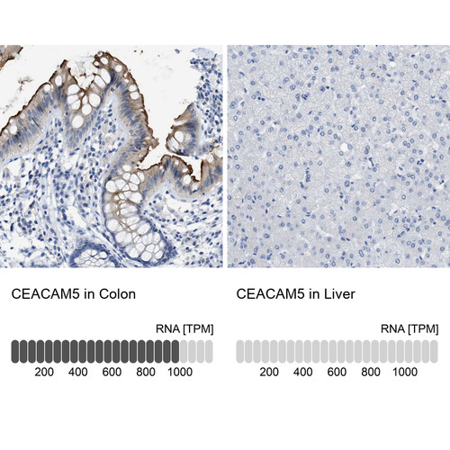 Immunohistochemistry analysis in human colon and liver tissues using HPA019758 antibody. Corresponding CEACAM5 RNA-seq data are presented for the same tissues.