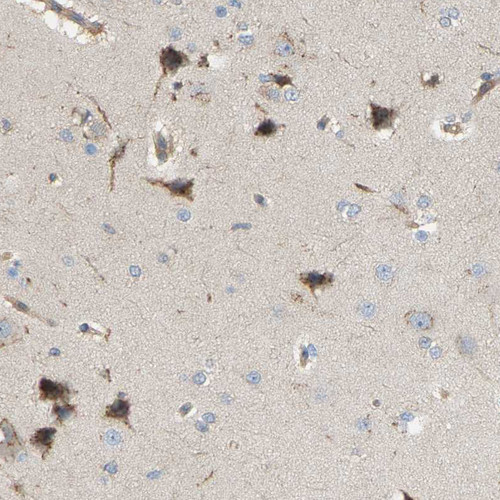 Immunohistochemical staining of human cerebral cortex shows moderate cytoplasmic positivity in neurons.