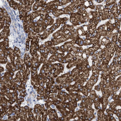 Immunohistochemical staining of human liver shows strong cytoplasmic positivity in hepatocytes.