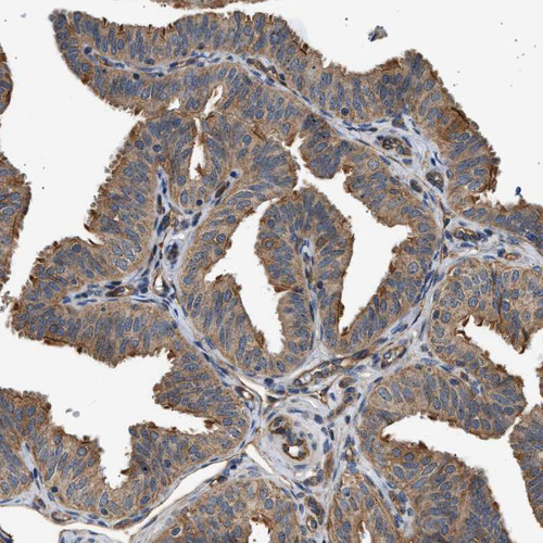 Immunohistochemical staining of human fallopian tube shows strong cytoplasmic and membranous positivity in glandular cells.