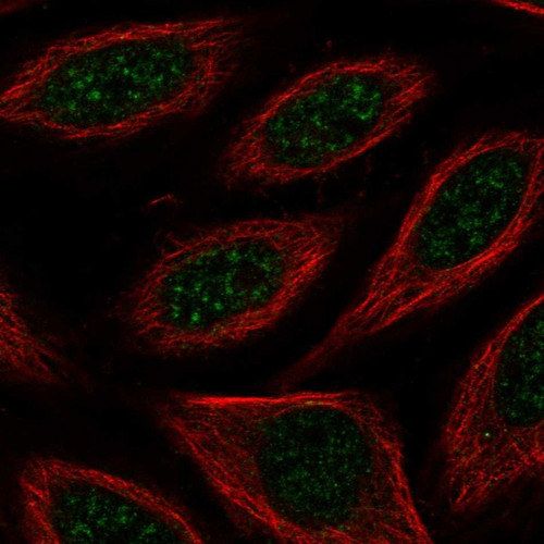 Immunofluorescent staining of human cell line SiHa shows localization to nuclear speckles.