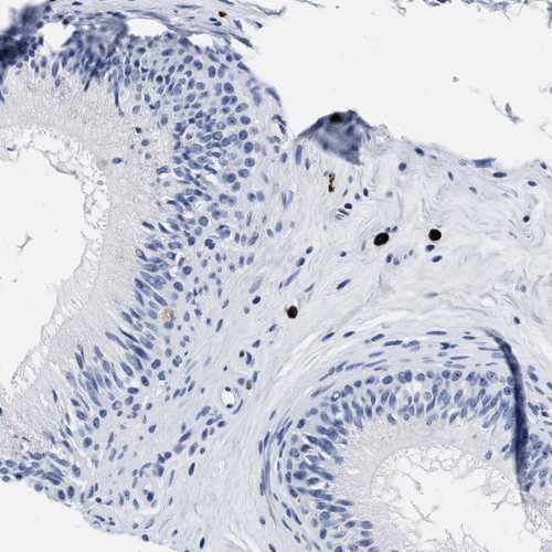 Immunohistochemical staining of human epididymis shows strong cytoplasmic positivity in lymphocytes.
