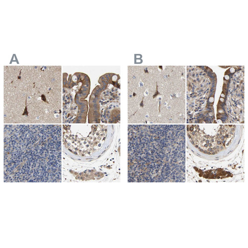 Immunohistochemical staining of human cerebral cortex, colon, lymph node and testis using Anti-CCDC155 antibody HPA019937 (A) shows similar protein distribution across tissues to independent antibody HPA019940 (B).