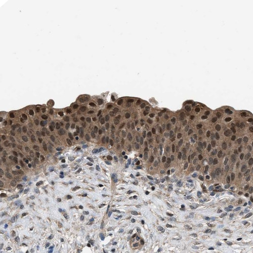 Immunohistochemical staining of human urinary bladder shows nuclear and cytoplasmic positivity in urothelial cells.