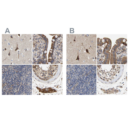 Immunohistochemical staining of human cerebral cortex, colon, lymph node and testis using Anti-CCDC155 antibody HPA019940 (A) shows similar protein distribution across tissues to independent antibody HPA019937 (B).