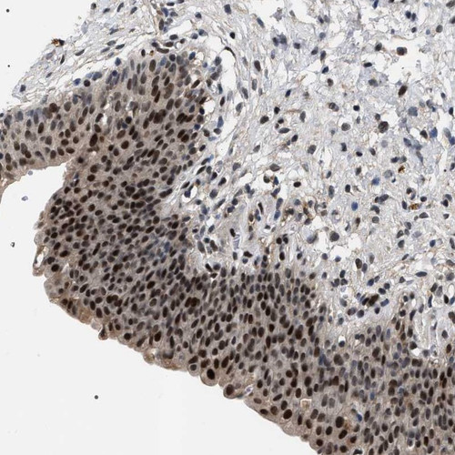 Immunohistochemical staining of human urinary bladder shows strong nuclear positivity in urothelial cells.