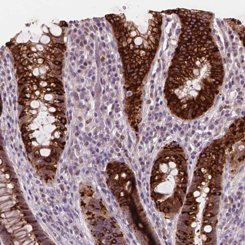 Immunohistochemical staining of human rectum shows strong cytoplasmic positivity in glandular cells.