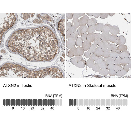 Immunohistochemistry analysis in human testis and skeletal muscle tissues using HPA020339 antibody. Corresponding ATXN2 RNA-seq data are presented for the same tissues.