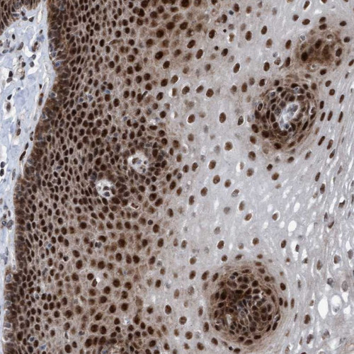 Immunohistochemical staining of human esophagus shows strong nuclear positivity in squamous epithelial cells.